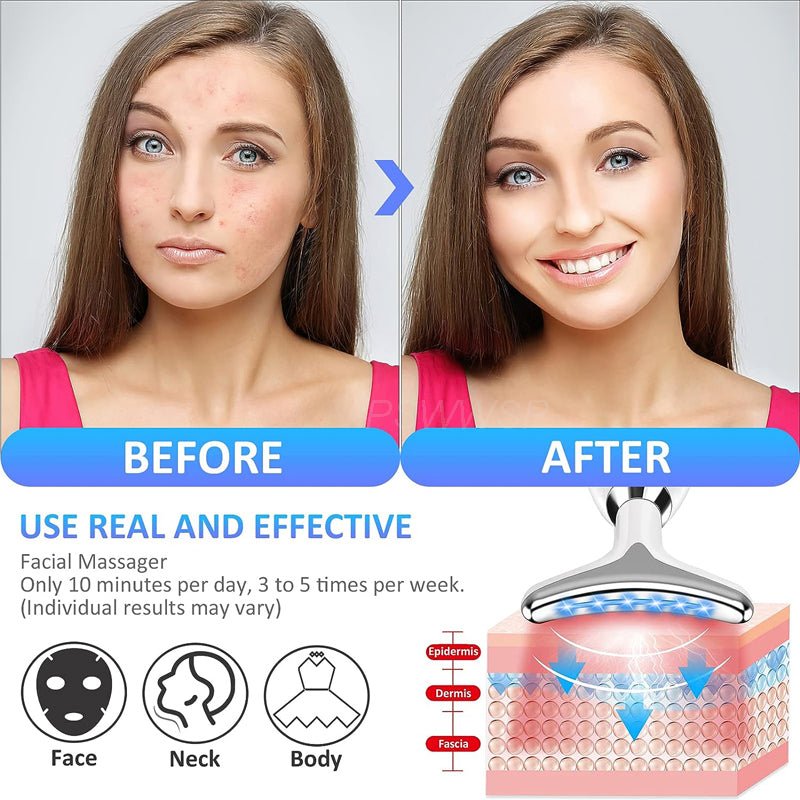 Facial Beauty Device Lifting Tighten Skin Care Tool | Fashionsarah.com