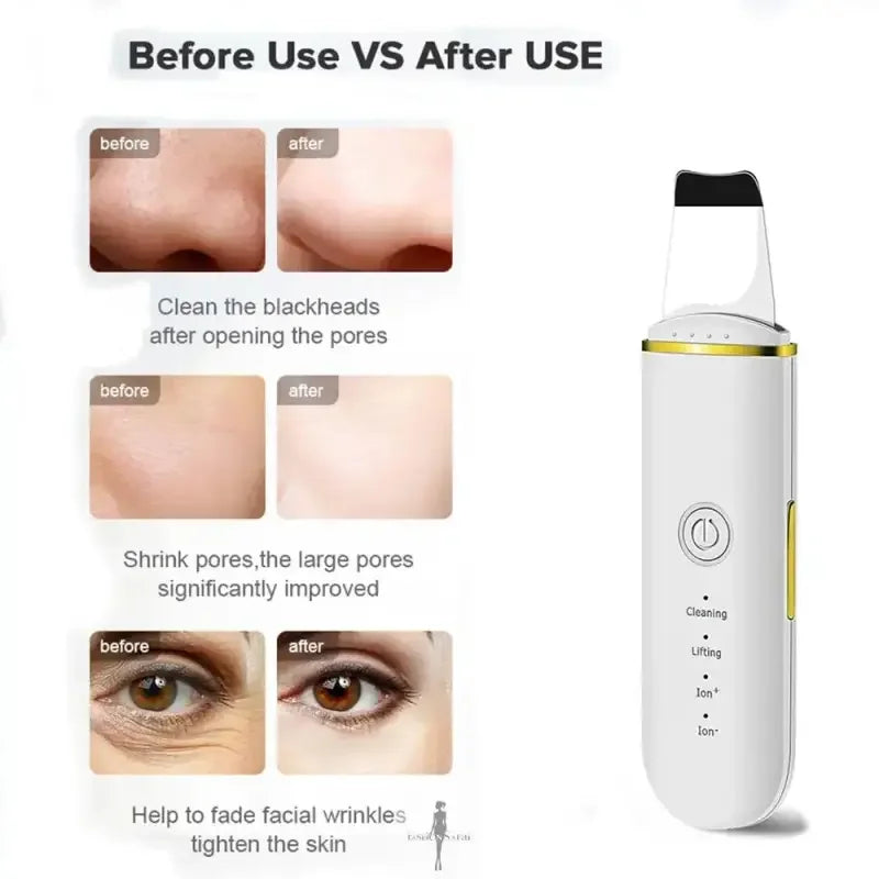 Fashionsarah.com Fashionsarah.com Beauty Ultrasonic Skin Scrubber