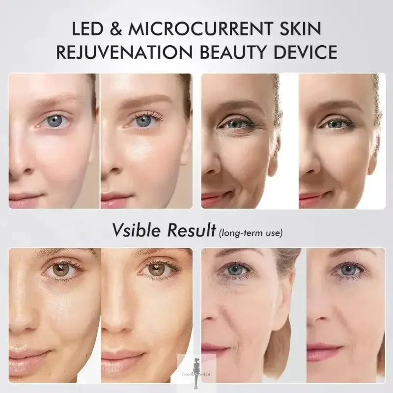 Fashionsarah.com Fashionsarah.com New Ager Booster Pro Skin Therapy Beauty Device 6 in 1