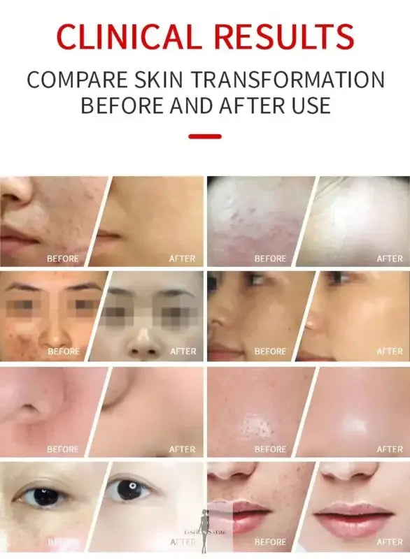 Fashionsarah.com Fashionsarah.com Professional 7 Colors PDT LED Face Lift Beauty Machine