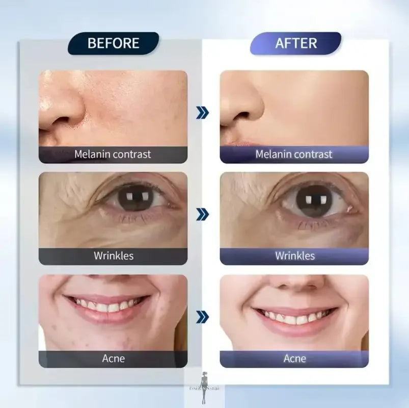 Fashionsarah.com Fashionsarah.com Professional 7 Colors PDT LED Face Lift Beauty Machine