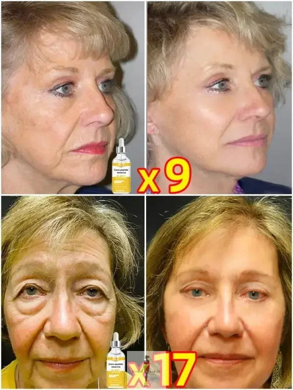 Before-and-after images showcasing the effectiveness of Anti-Aging Serum as a wrinkle remover