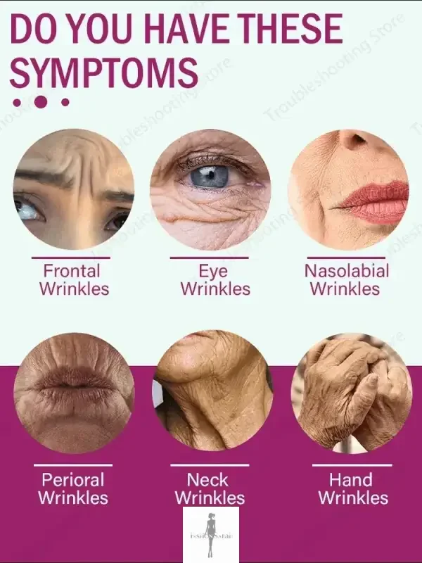 Image of wrinkle symptom chart for Anti-Aging Serum containing wrinkle remover technology
