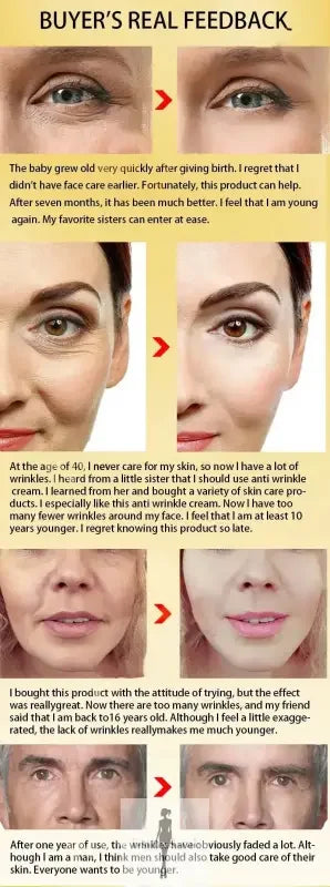 Anti-aging serum wrinkle remover advertisement showcasing effective wrinkle remover treatment