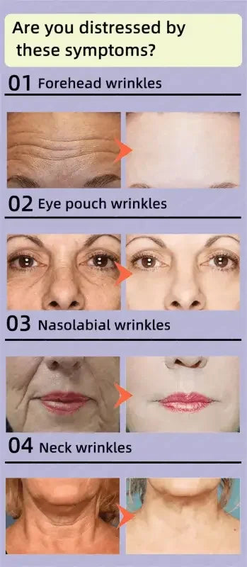 Anti-aging serum wrinkle remover advertisement showcasing effective wrinkle removal solution