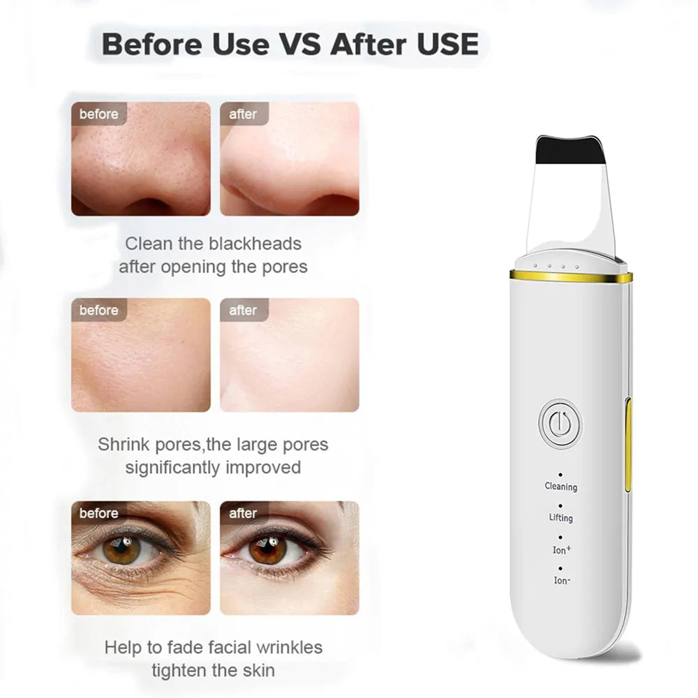 Beauty Ultrasonic Skin Scrubber | Fashionsarah.com